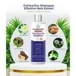 Psoriasis & Dry Scalp Relief Shampoo